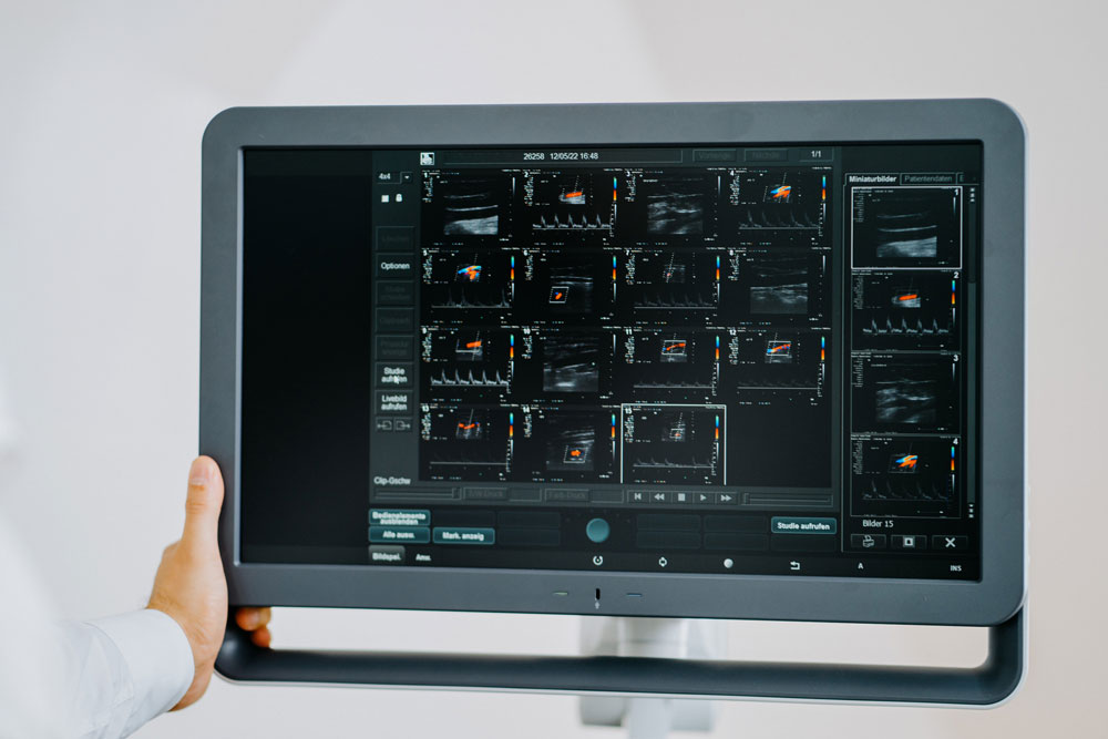 neurologe-ludwigsburg-dr-teufel-la4-2026
